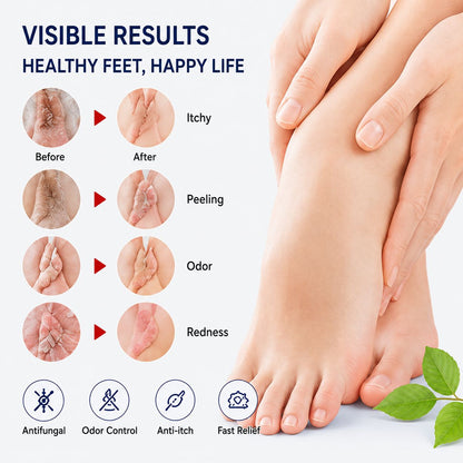 Uhulk Cooling Foot Deodorant