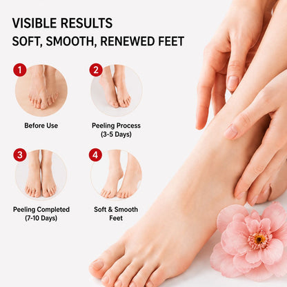 Uhulk Exfoliating Foot Mask