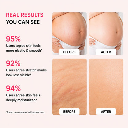 Uhulk Shea Butter Stretch Mark Cream
