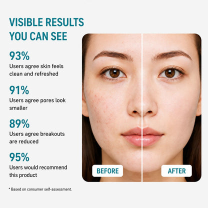 Uhulk Acne Control Cleanser