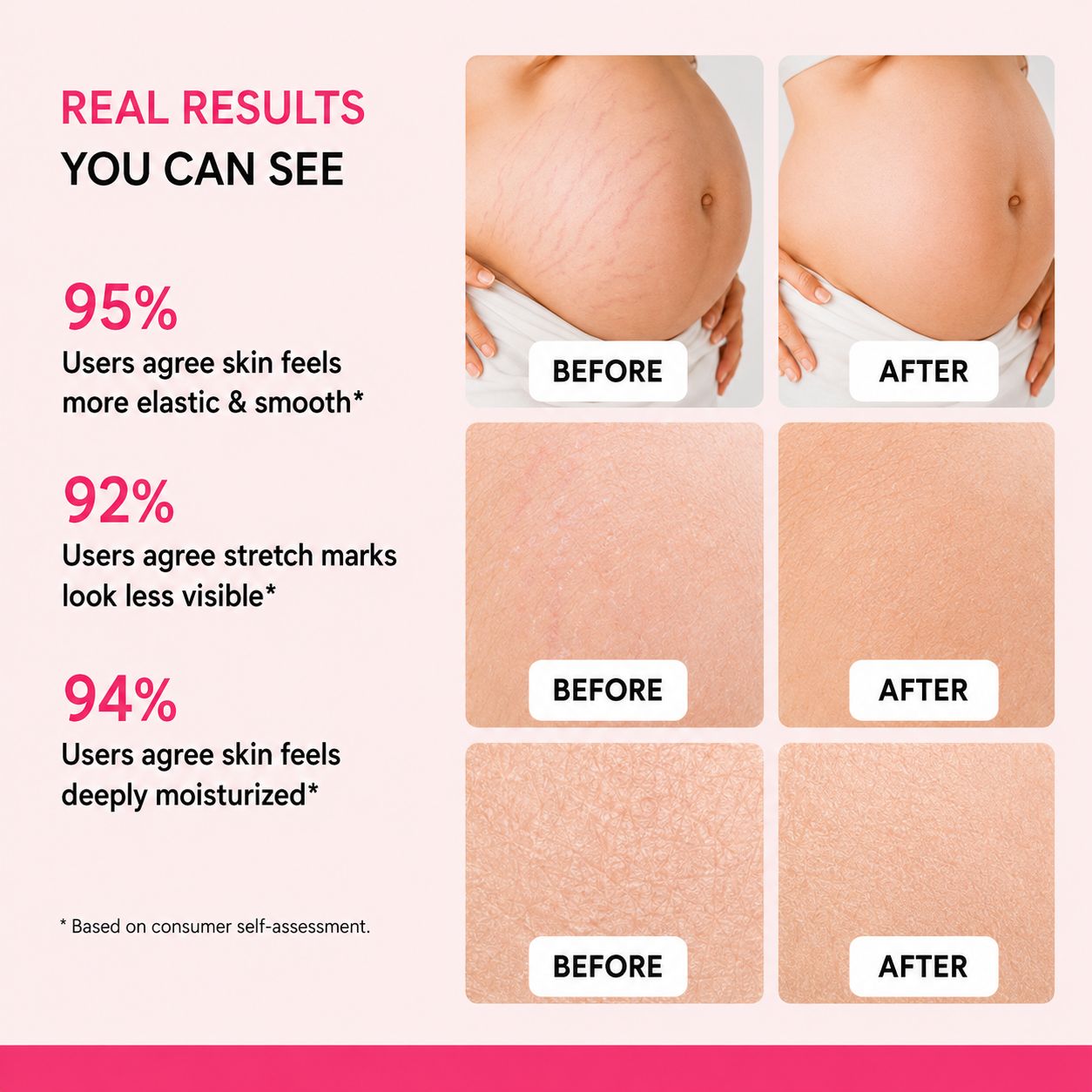 Uhulk Scar Repair Stretch Mark Cream