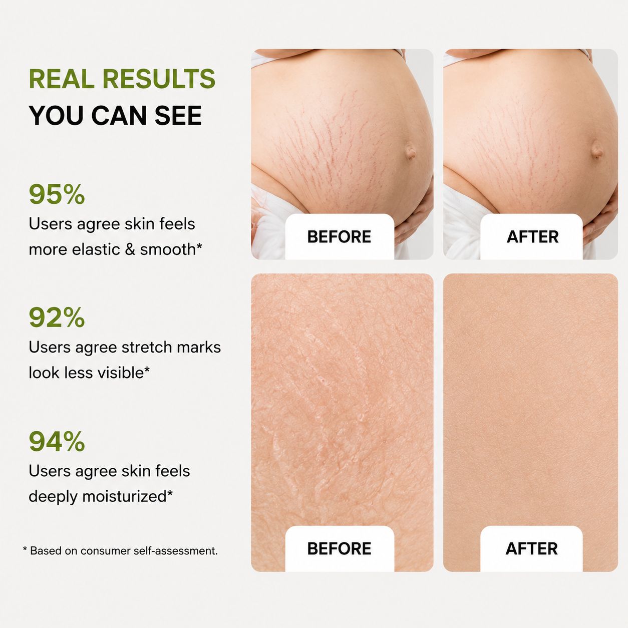 Uhulk Pregnancy Care Stretch Mark Cream