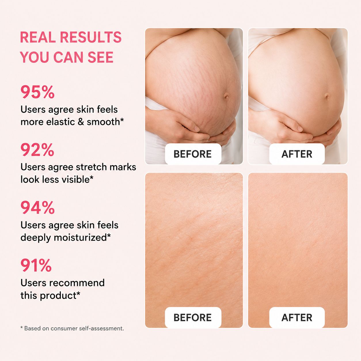 Uhulk Collagen Stretch Mark Cream
