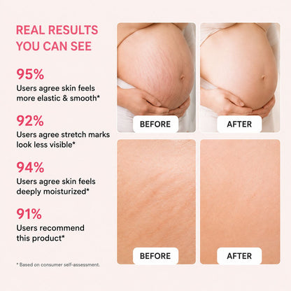 Uhulk Collagen Stretch Mark Cream