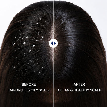 Uhulk Anti Dandruff Oil Control Shampoo