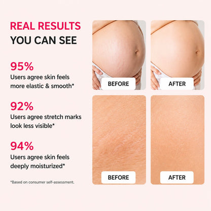 Uhulk Elasticity Boost Stretch Mark Cream
