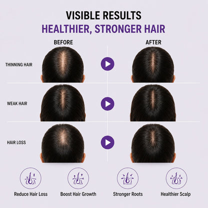 Uhulk Scalp Care Essence